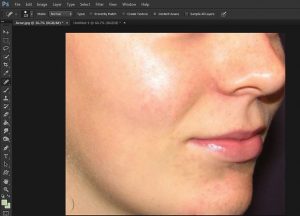 آموزش حذف جوش های صورت در فتوشاپ