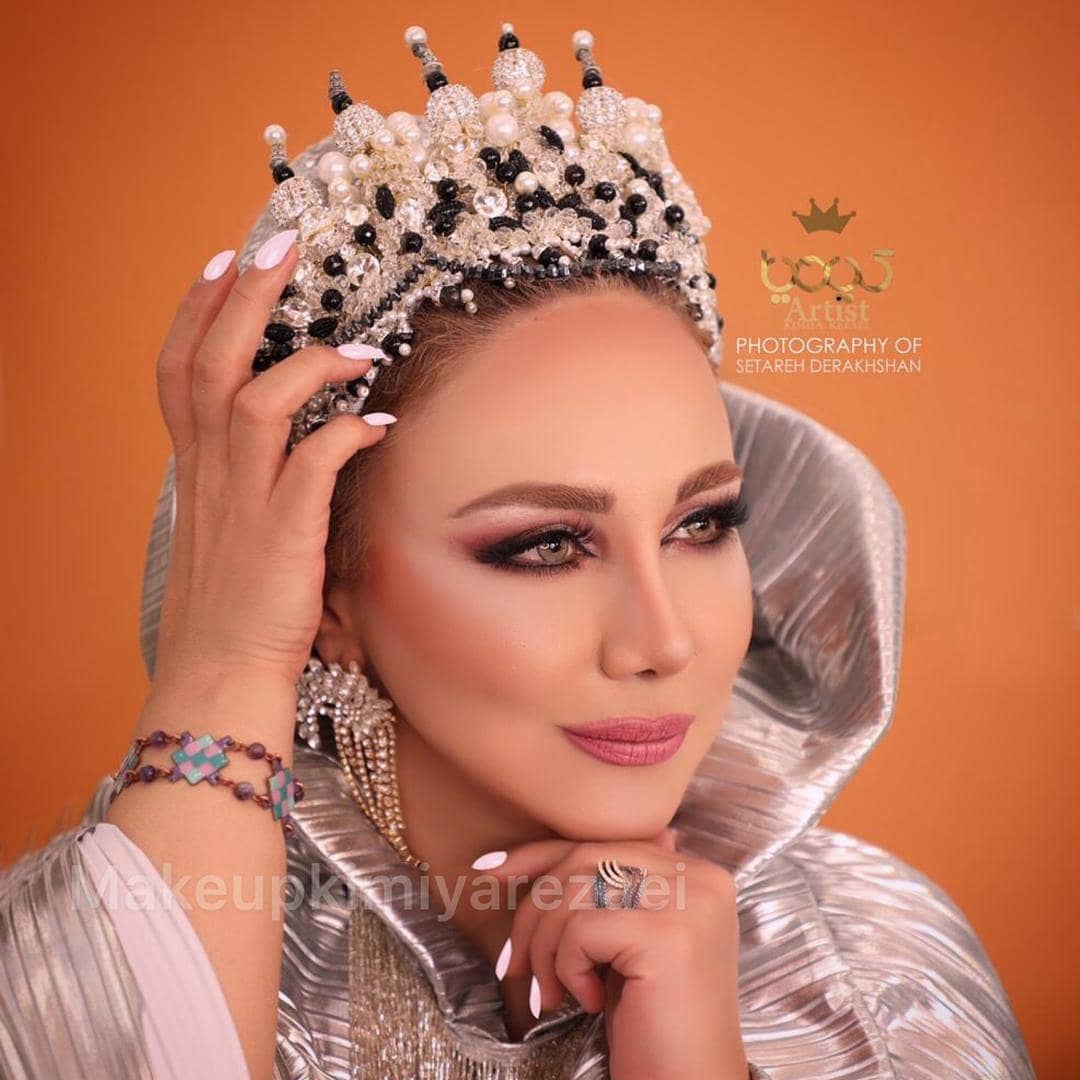 عکس بهنوش بختیاری در سالگرد ازدواجش