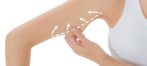 7 چیزی که بعد از عمل لیپوساکشن باید منتظرش باشیم