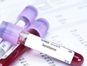 (آزمایش میزان سروتونین) تست 5-HT