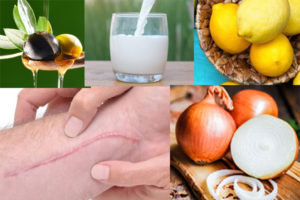 معرفی 10 روش خانگی برای از بین بردن جای بخیه تازه و قدیمی