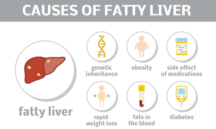 دلایل کبد چرب
