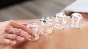 با 8 مورد از مزایای بادکش درمانی برای سلامت بدن آشنا شوید