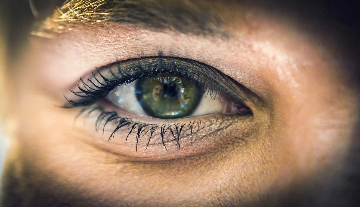 آیا علت سیاهی دور چشم کم خونی است؟