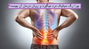چرا رگ سیاتیک درد میگیرد و روش درمان آن چیست؟