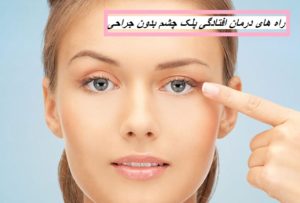 راه های درمان افتادگی پلک چشم بدون جراحی چیست؟