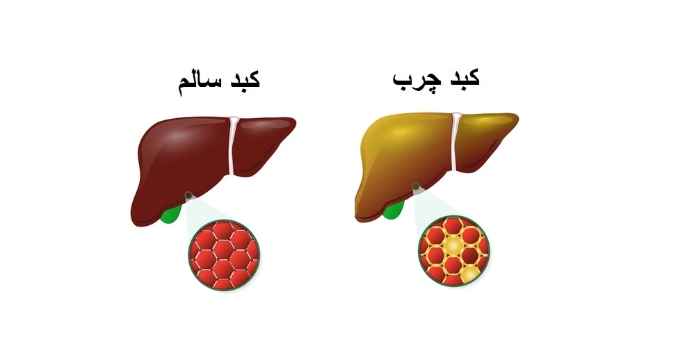 کبد نقش حیاتی در سالم نگه داشتن تعادل بیوشیمیایی دارد.