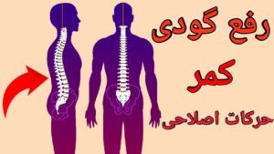 سه تمرین برای بهبود گودی کمر