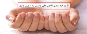 علت خم شدن ناخن های دست به سمت پایین چیست؟