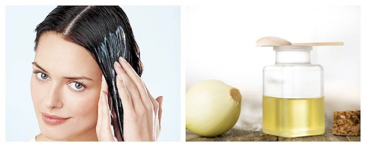 آیا آب پیاز برای ریزش مو مفید است؟