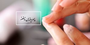 پسوریازیس ناخن چیست | عوارض پسوریازیس ناخن | درمان پسوریازیس ناخن