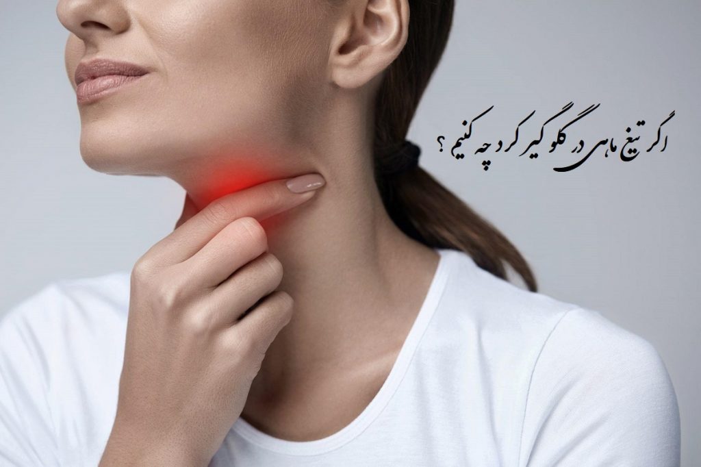 اگر تیغ ماهی در گلو گیر کرد چه کنیم؟