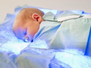 زردی نوزاد (علائم، دلایل، روش تشخیص، راه درمان، نشانه های خوب شدن)