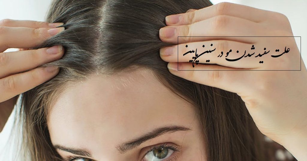 علت سفید شدن مو در سنین پایین + راه جلوگیری از سفید شدن مو در جوانی