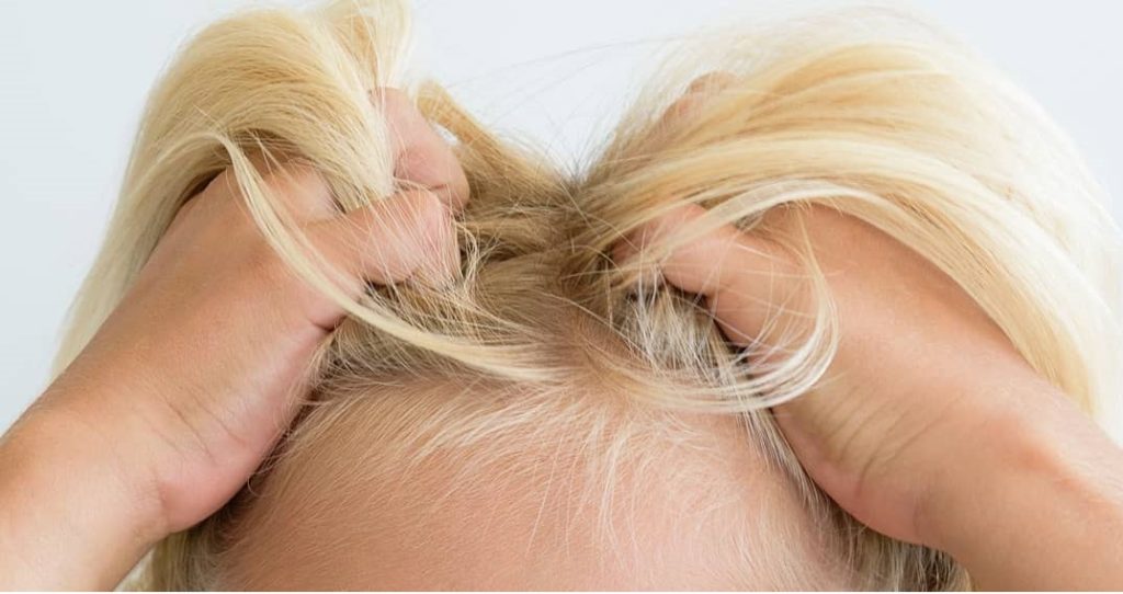 شپش از چی بدش میاد؟ (چه چیزی باعث نابودی شپش می شود)