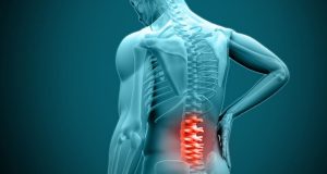 ورزش برای درمان فتق دیسک کمر