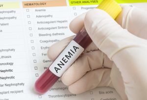 کم خونی چیست (انواع، علائم، دلایل و روش های درمان کم خونی)