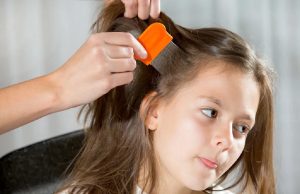 شپش سر در کودکان و بهترین درمان خانگی برای آن