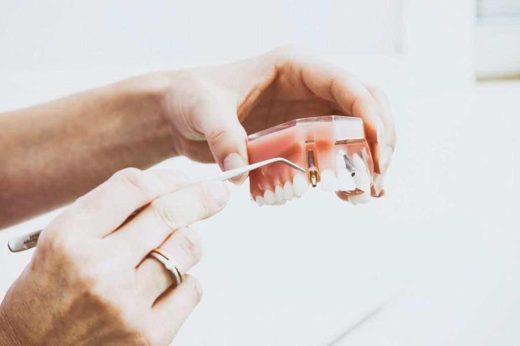عوارض و خطرات ایمپلنت دندان چیست؟