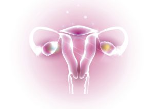 رابطه تنبلی تخمدان و وزن؛ چگونه با PCOS وزن کم کنیم؟