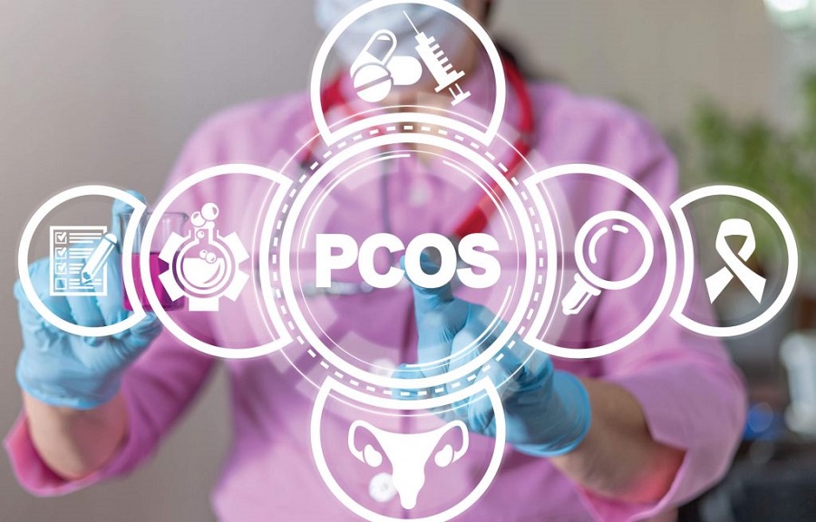 pcos چیست